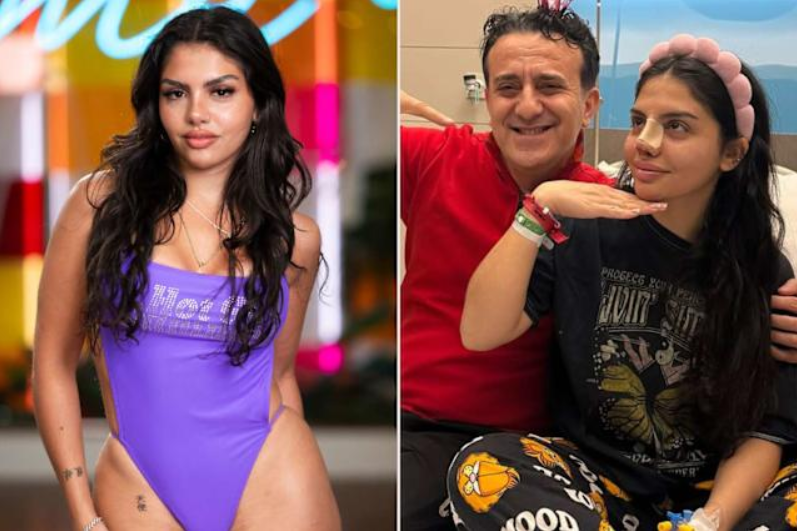 Huda Love Island Before Surgery